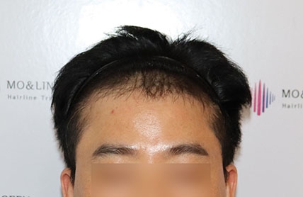 치료후기 이미지